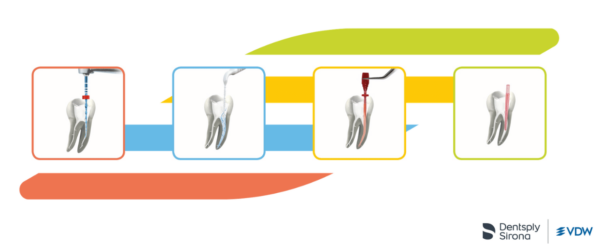 VDW Root Canal Files